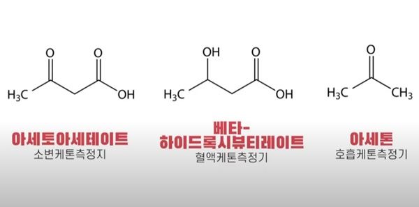 케톤-수치-측정