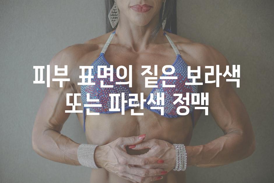 피부 표면의 짙은 보라색 또는 파란색 정맥