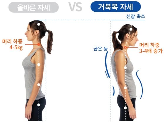 올바른-자세와-거북목-자세