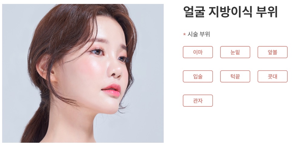 지방이식 부위