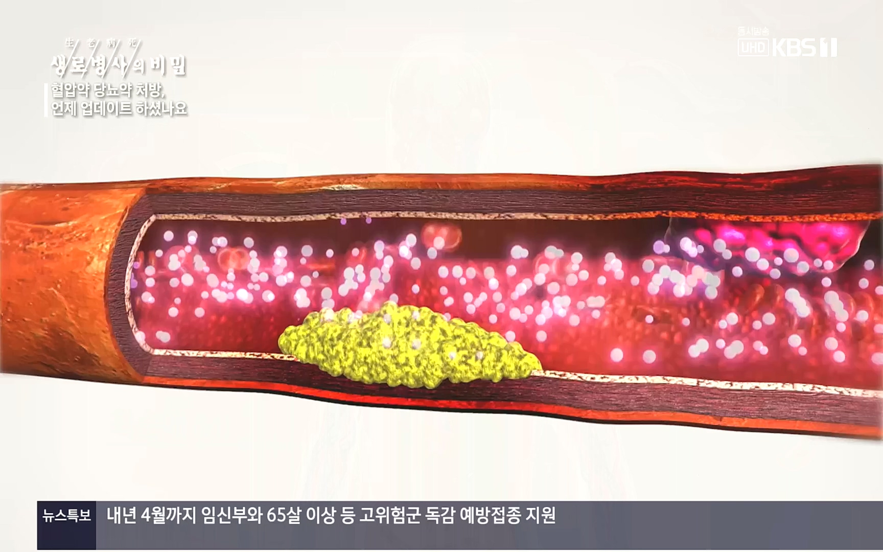 생로병사의 비밀.E838.221005p.H264-F1RST.mp4_20221008_182150.602.jpg