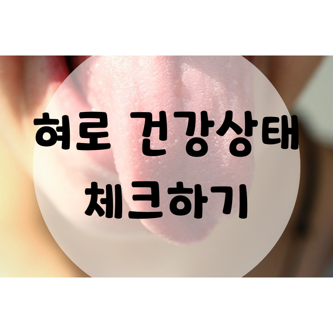  혀 건강상태 체크해보자