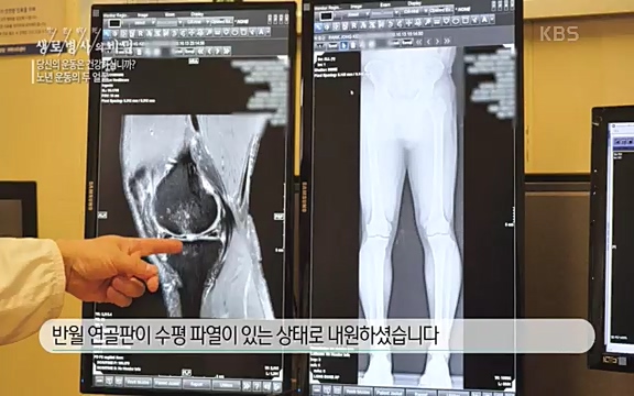 [821회] 생로병사의 비밀 - KBS821회] 생로병사의 비밀.ts_20220824_145730.676.jpg