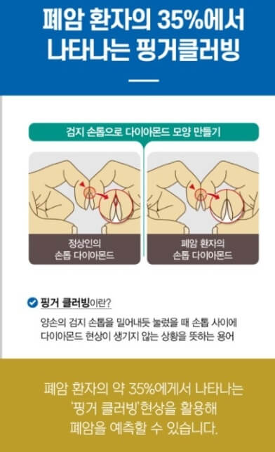 핑거클러빙