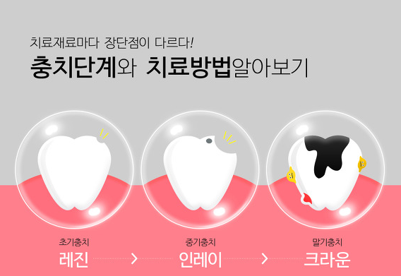  올바른 치과보험 가입요령 알아보세요