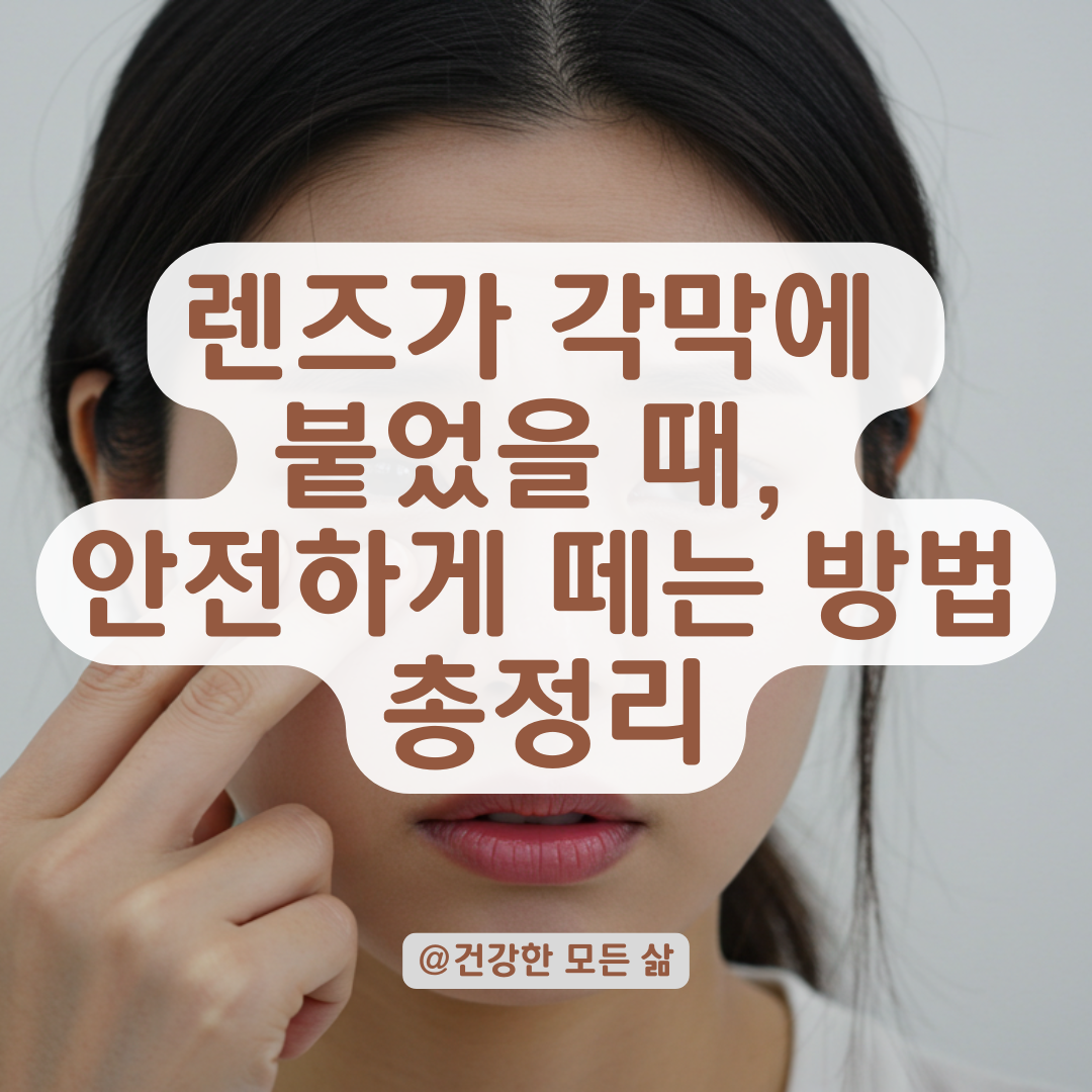 렌즈가 각막에 붙어 안 떨어진다면? 각막 손상 피하는 응급요령