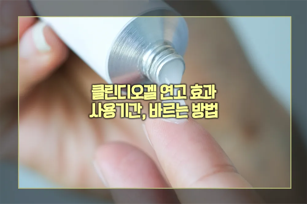 클린디오겔 연고 효과 사용기간 바르는 방법