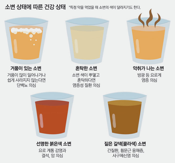  평소와 다른 소변 색, 건강의 적신호