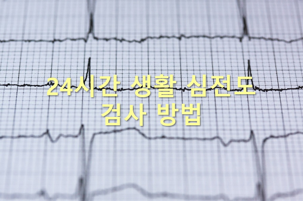  일상생활의 심장박동을 관찰하는 24시간 생활 심전도검사 방법