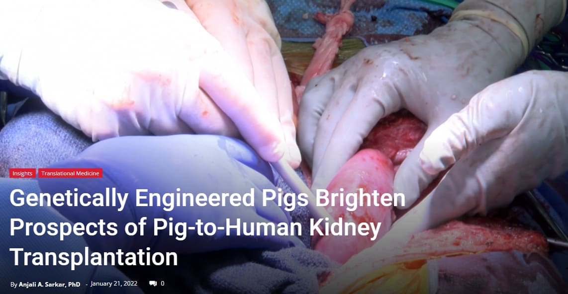 인간에게 사상 최초 돼지 신장 이종 이식 성공 VIDEO Pig-to-human kidney transplant 3D animation