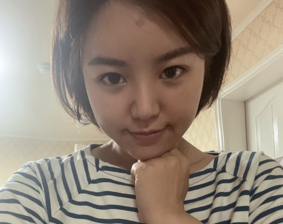 이마필러잘하는곳 후기! 18