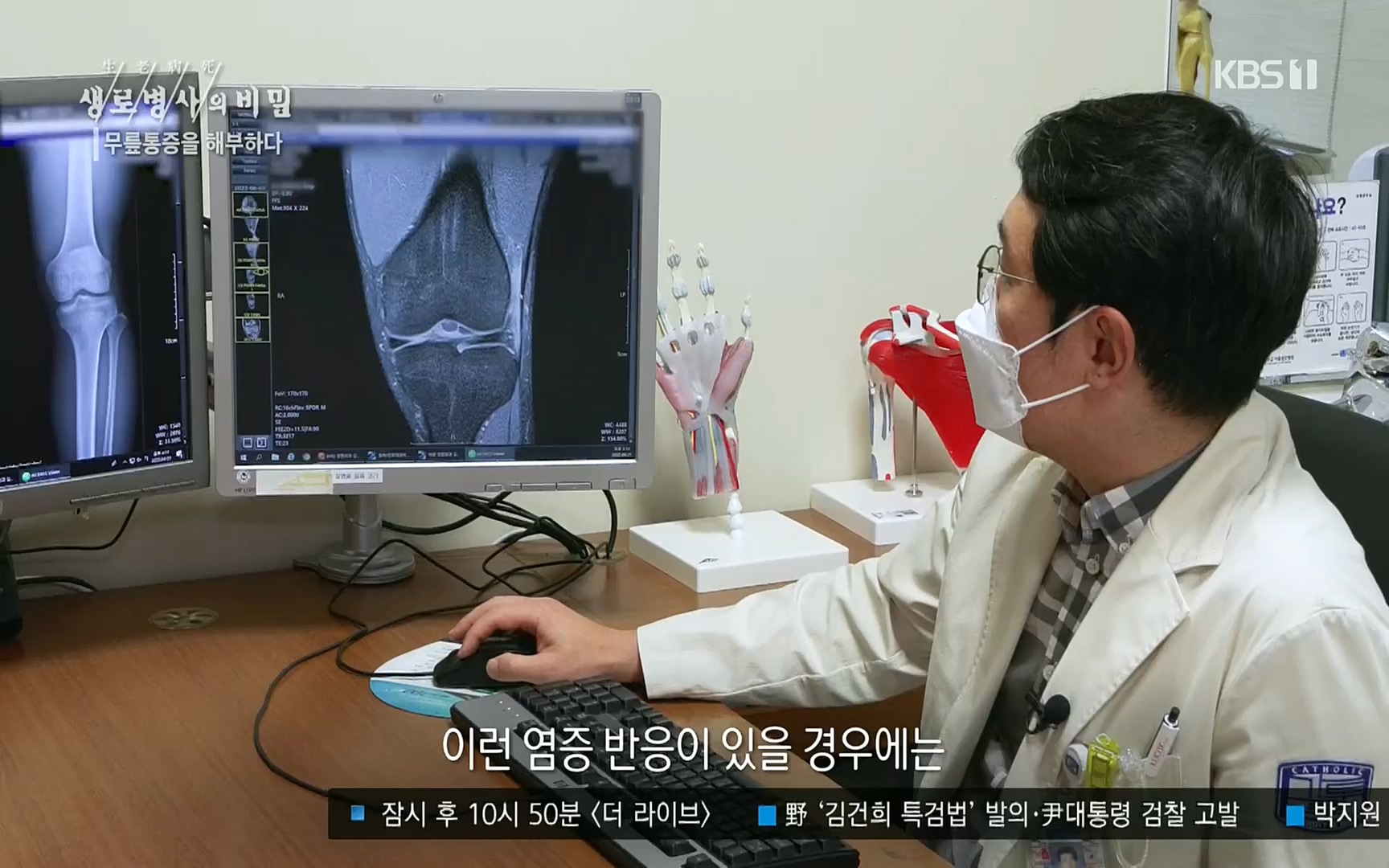 생로병사의 비밀.E834.220907p.H264-F1RST.mp4_20220908_210426.514.jpg