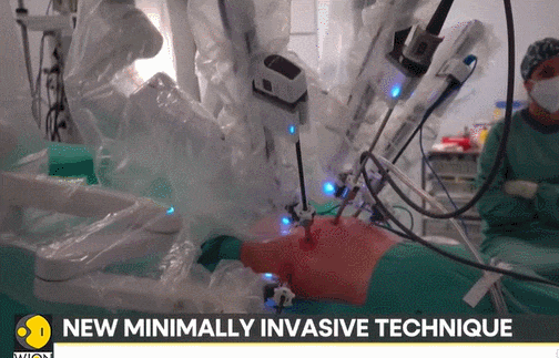 스페인&#44; 로봇만으로 세계 최초 폐 이식 수술 성공 VIDEO:Spain sees the world&#39;s first lung transplant performed entirely by robot