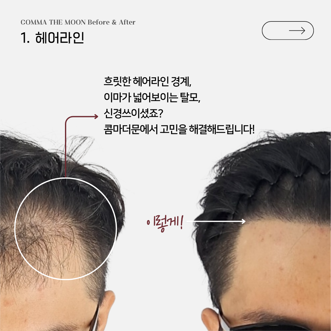 콤마더문 이미지