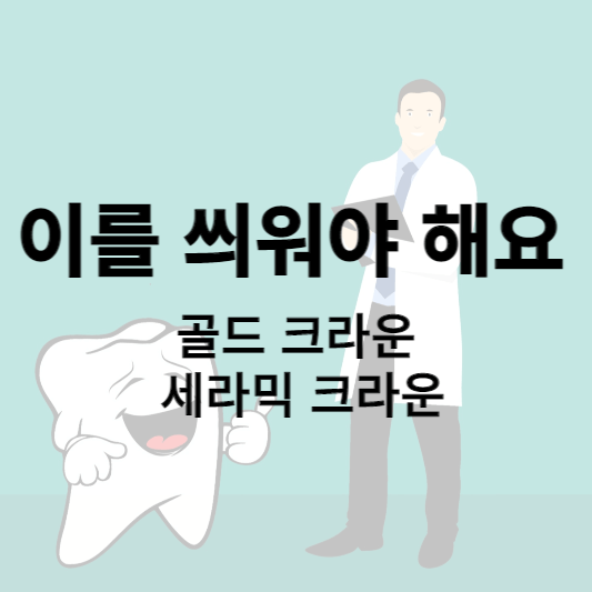 크라운 썸네일