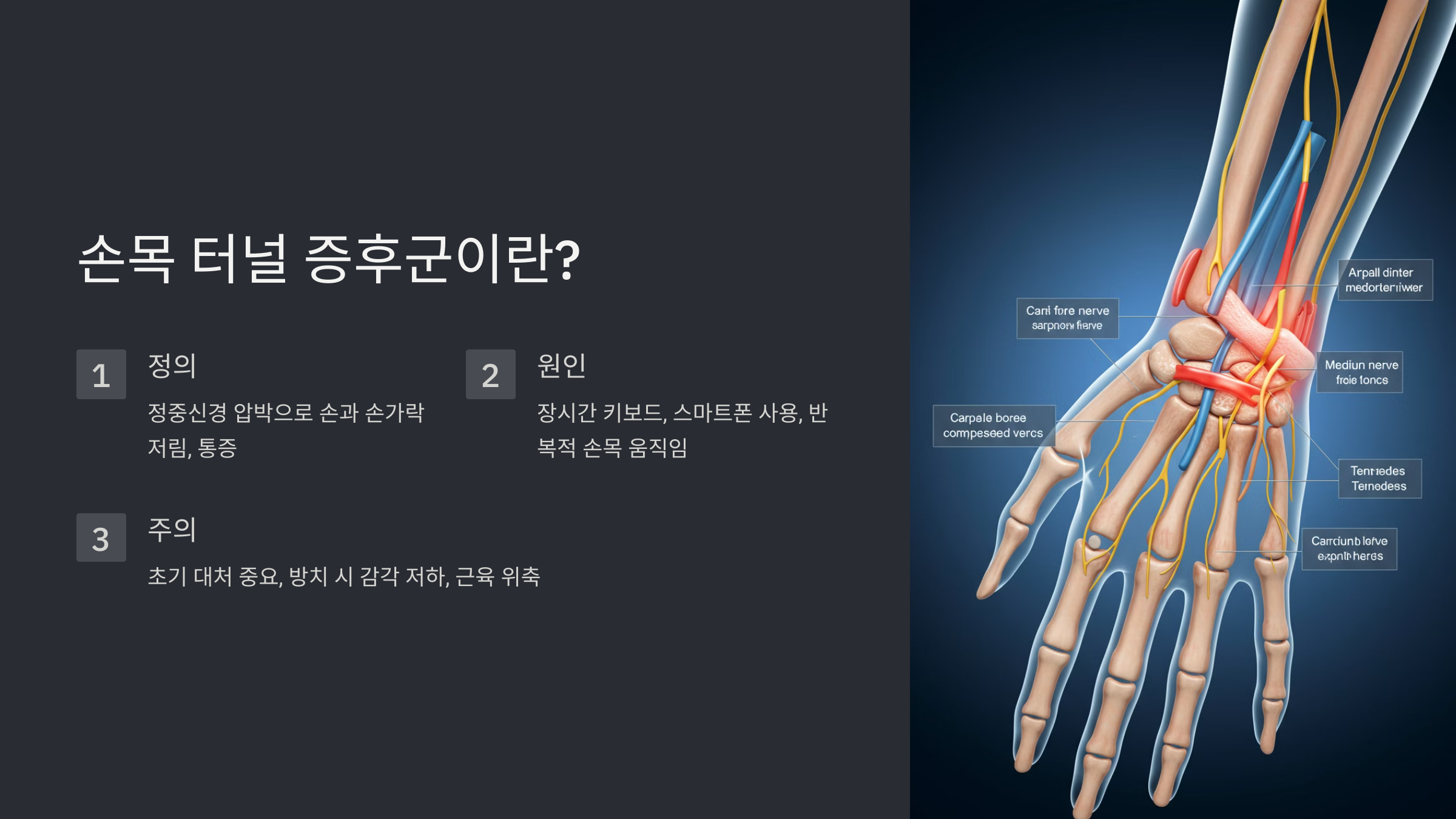 1. 손목 터널 증후군이란?