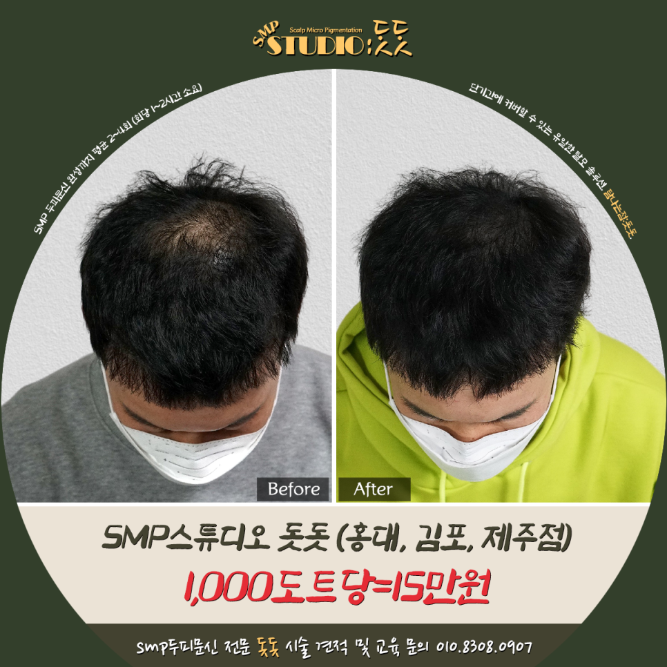  머리 문신 가격 비용 확인과 후기까지