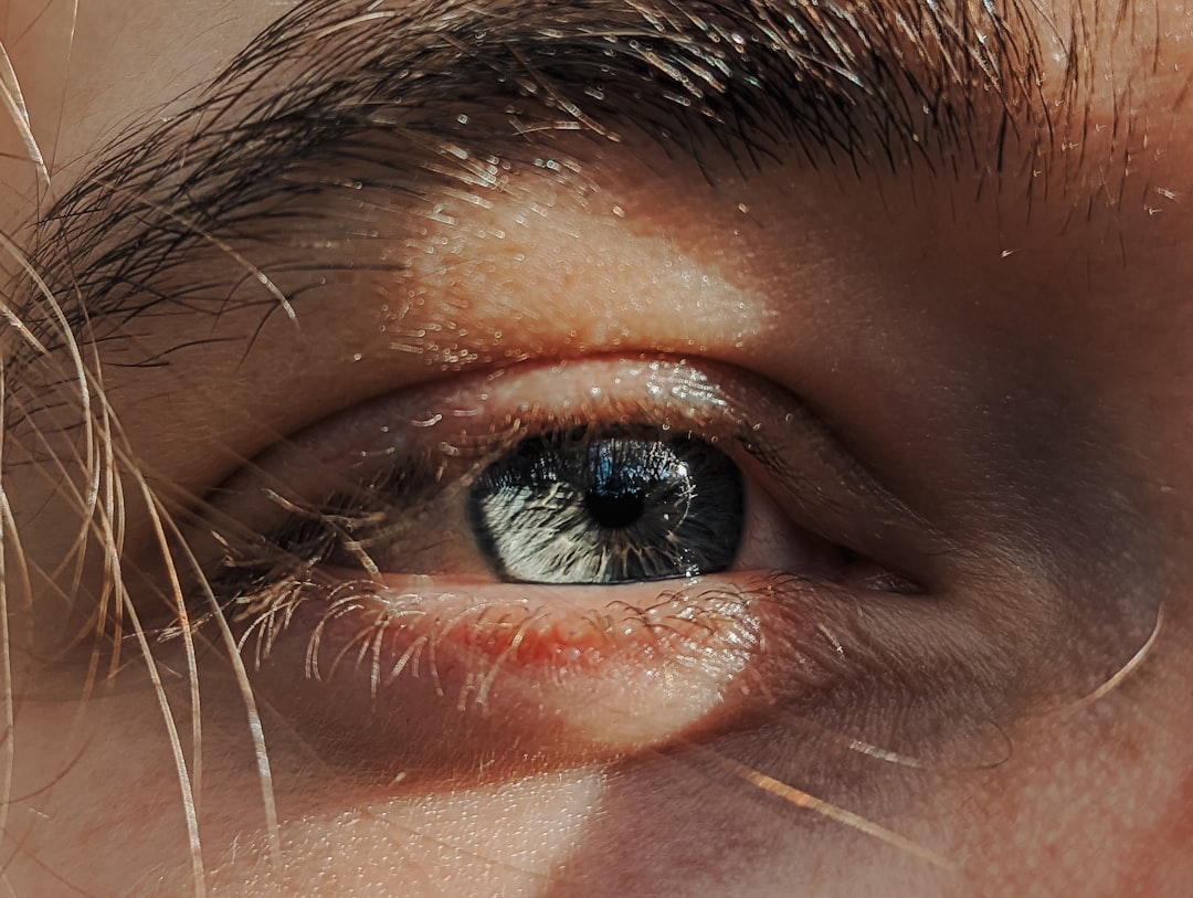 Cataract