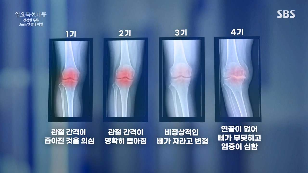 일요특선 다큐멘터리.E341.240318p-NEXT.mp4_20240317_183255.870.jpg