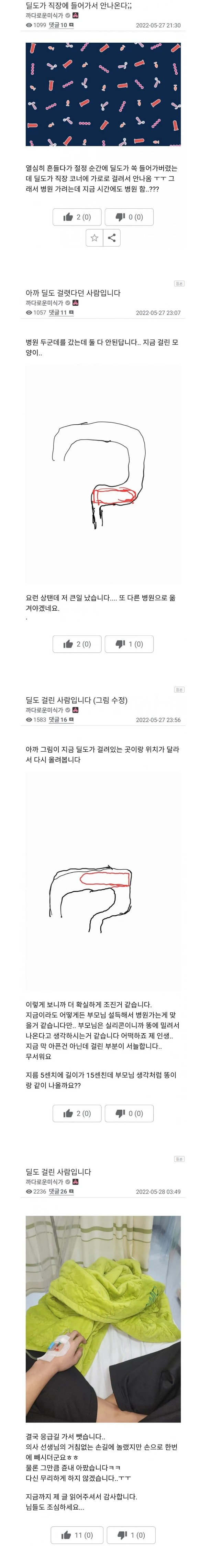  여성 자X기구가 일직선이 아닌이유