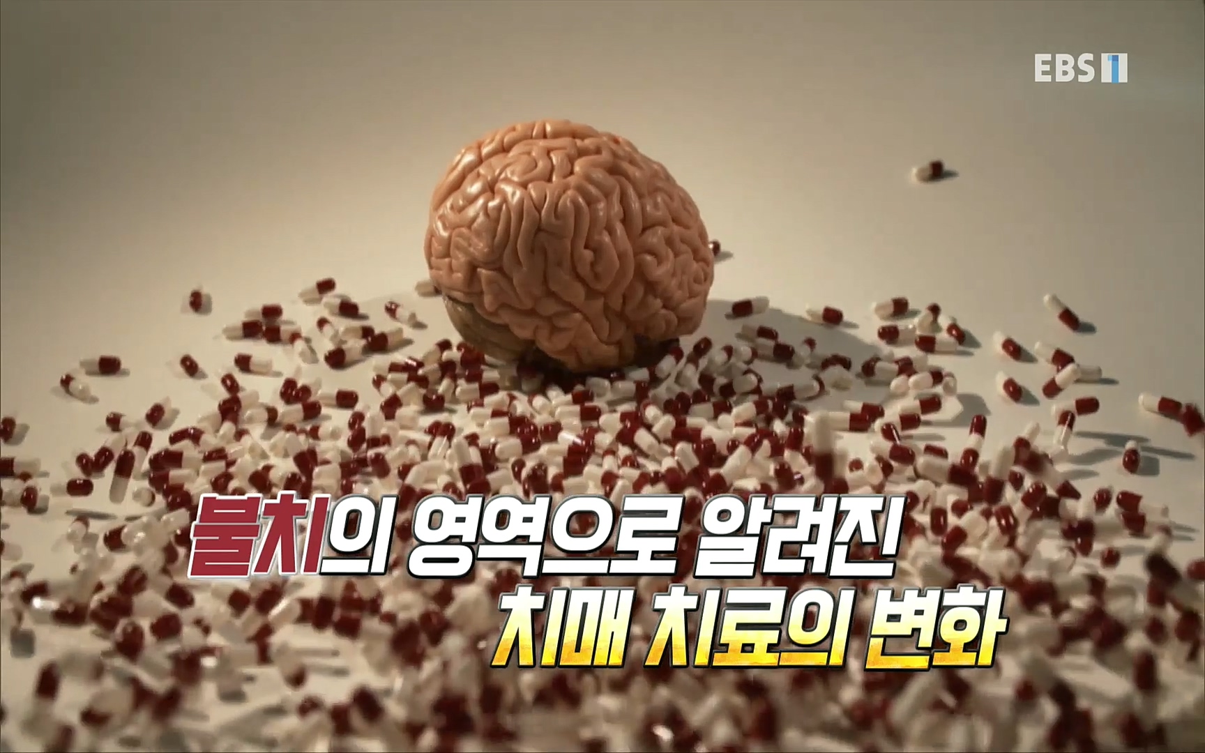 EBS 명의 헬스케어 - TV - 교육의 중심 EBS명의 15년 치매 치료의 패러다임이 바뀐다.mp4_20220808_211002.572.jpg