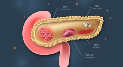 췌장에좋은음식이미지