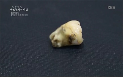 [670회] 생로병사의 비밀 - KBS670회] 생로병사의 비밀.ts_20220505_143211.712.jpg