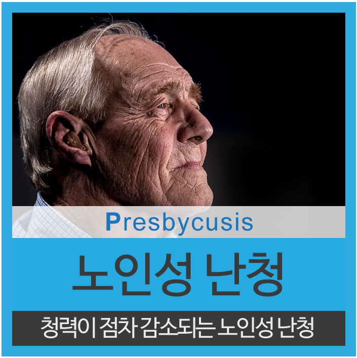  노인성난청 30대도 무시할수 없다
