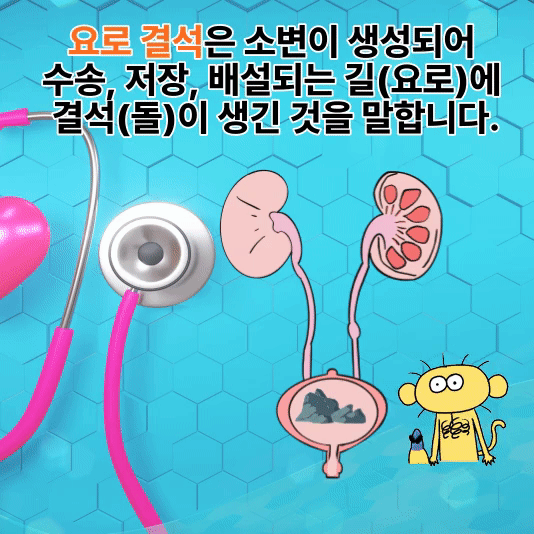 요로결석의 원인과 증상 및 예방과 치료법