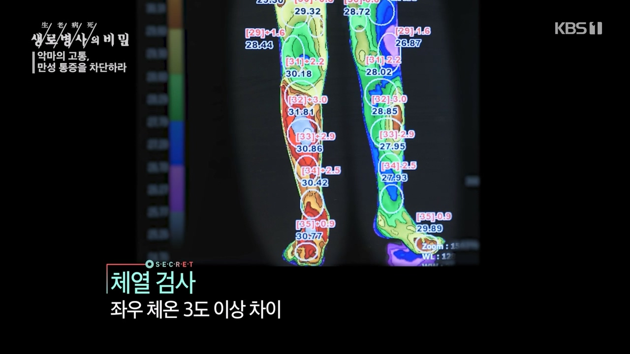 생로병사의 비밀.E897.240125p-NEXT.mp4_20240125_202225.820.jpg