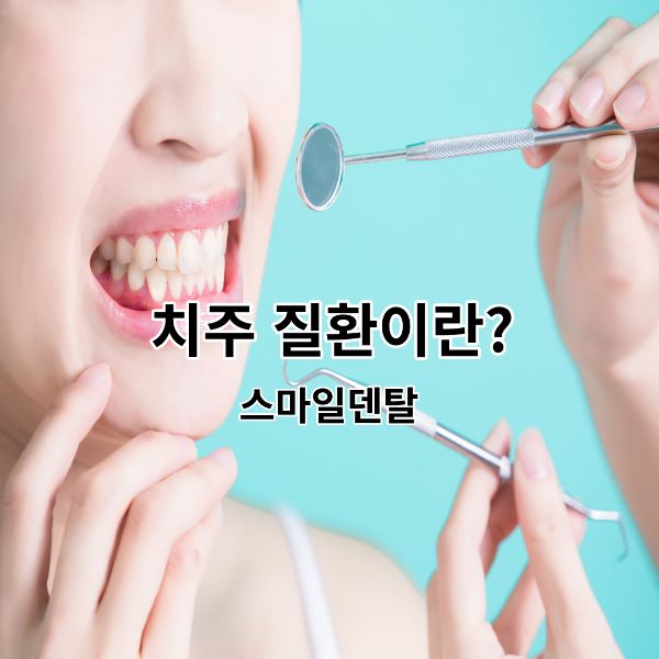 치아-치주질환-썸네일