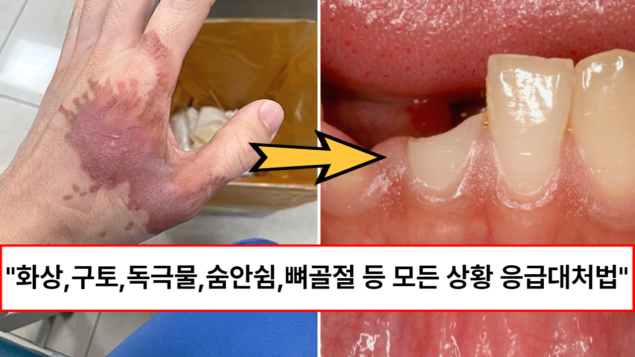 “미리 봐두고 3분안에 대처하면 살 수 있습니다” 일반인은 모른다는 119 메뉴얼에 나와 있는 13가지 응급 대처법