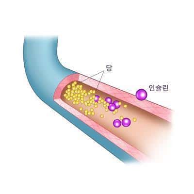 당뇨병 초기증상 총정리