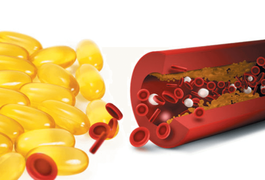 점점-혈행-흐름이-막히는-혈관과-옆에-놓여진-노란색-오메가3-영양제