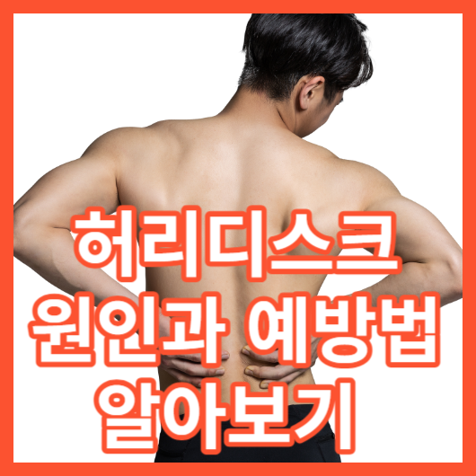  허리디스크 원인과 허리디스크 예방법 허리 건강 지키기 !