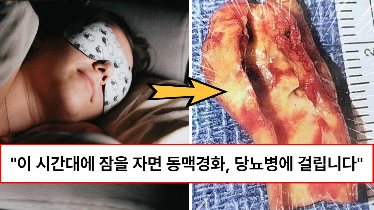 “늦게 자면 이런 일이 벌어집니다” 같은 시간을 자도 이 시간대에 잠자면 동맥경화, 당뇨병에 걸릴 확률이 높아지는 이것