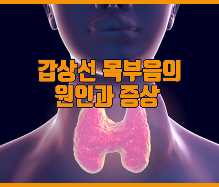 갑상선 목부음 원인과 증상 정리