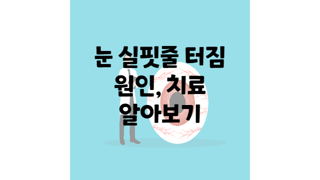  눈 실핏줄 터짐 원인 치료방법 모르고 지나치면 위험!