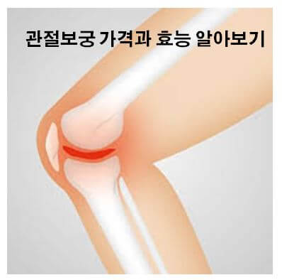  관절보궁 가격 및 효능