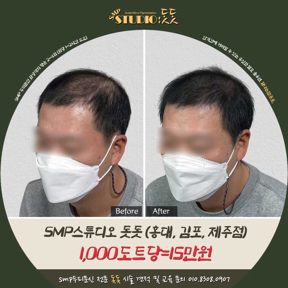  두피문신 이 정도 채워졌는데 어떰?