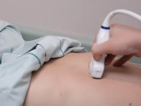 예방에 좋은 음식 간암 초기증상과 진단, 1