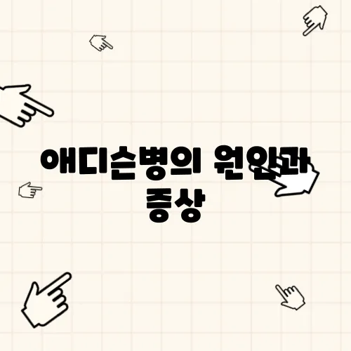 애디슨병의 원인과 증상, 치료 방법 총정리
