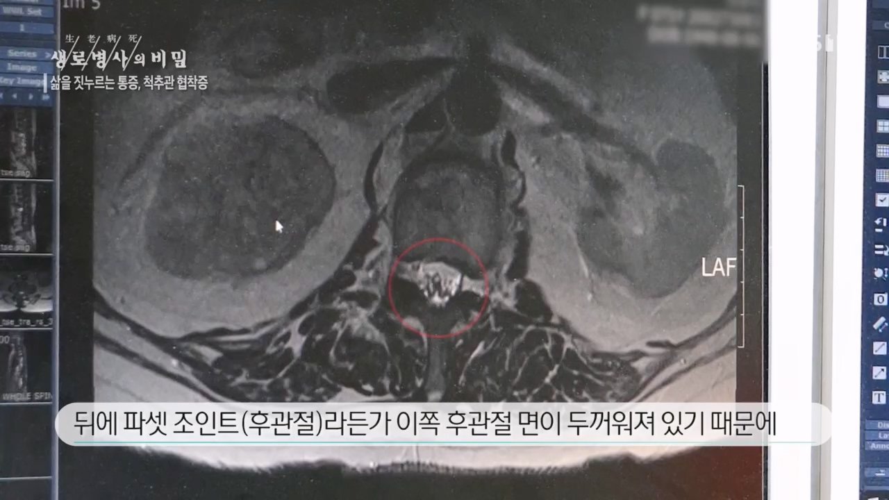 생로병사의 비밀.E866.230427p.H264-F1RST.mp4_20230427_202709.064.jpg