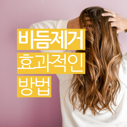  비듬 제거에 효과적인 방법