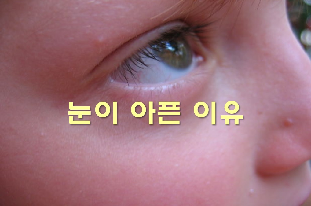  눈이 아픈 이유와 증상의 치료 방법