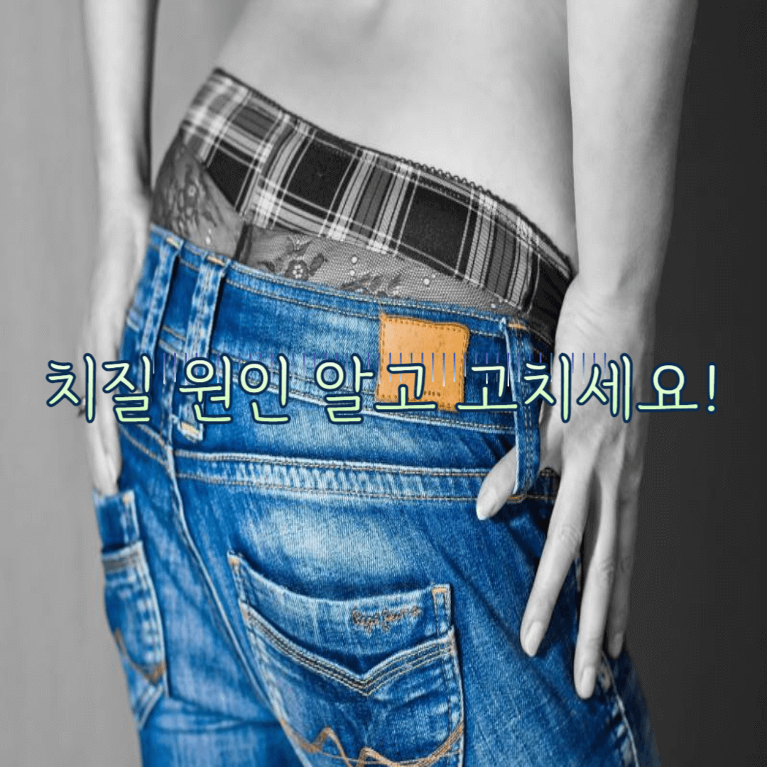 치질원인