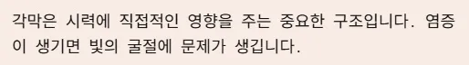 각멱염 전염성 비전염성 구분법 - 기본 개념과 원인