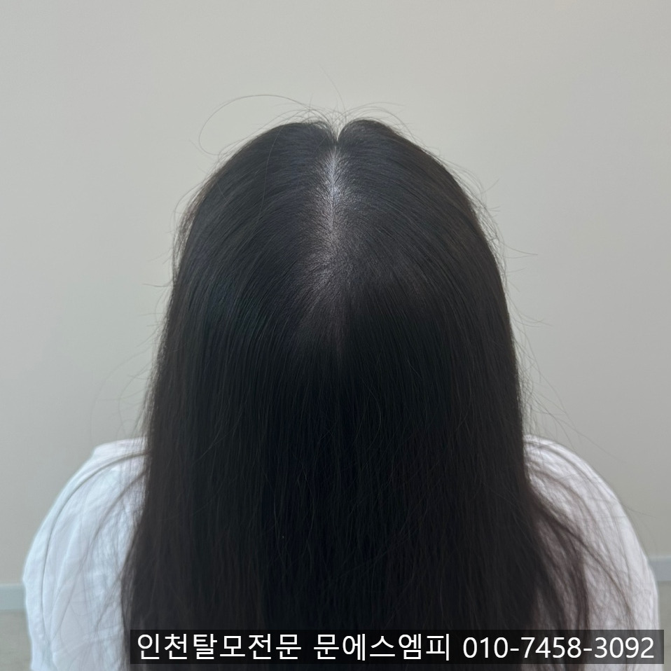 가르마 이미지