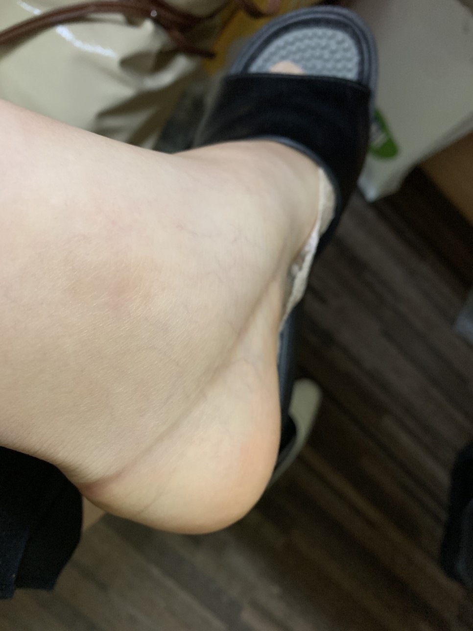 통증, 의료용 압박 스토킹 후기, 아기 크기, 체중, 증상, 태동, 배 크기, 우정 사진 촬영 30-34주 주물 사진 : 출산 휴가, 산전 우울증, 포유문 산부인과 산전 마사지, 다리 붓기, 손가락 15