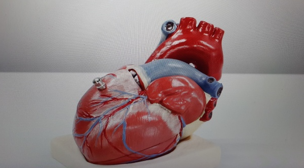 테이블에-놓여있는-심장모형
